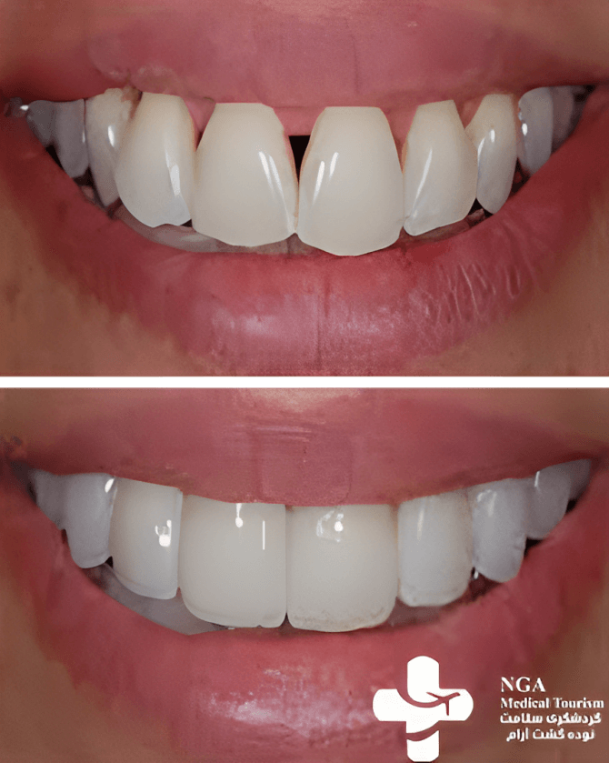 cosmetic dentistry before and after 2