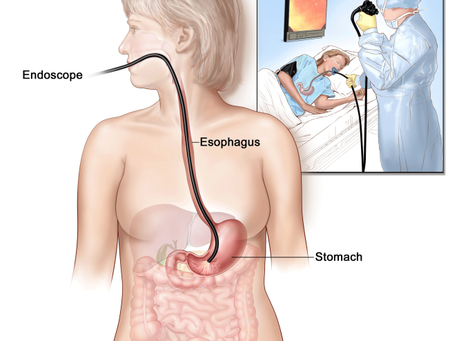Stomach cancer treatment in Iran