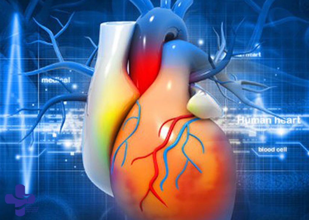 heart surgery in iran|Cardiovascular Surgery