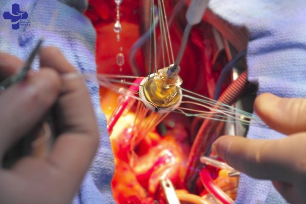 Heart valve leaking surgery
