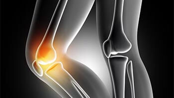 Knee-Osteotomy