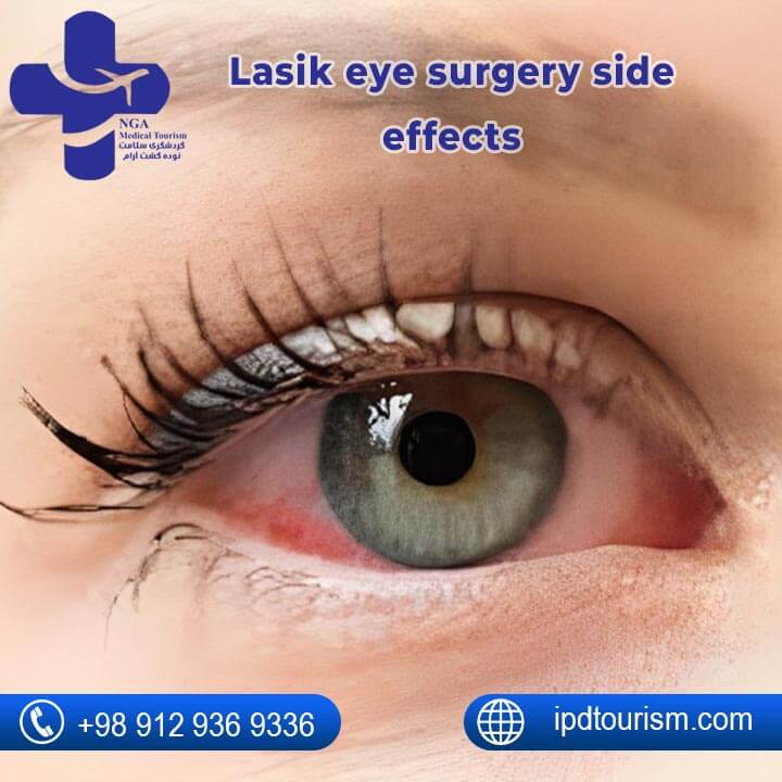 Lasik eye surgery Side Effects