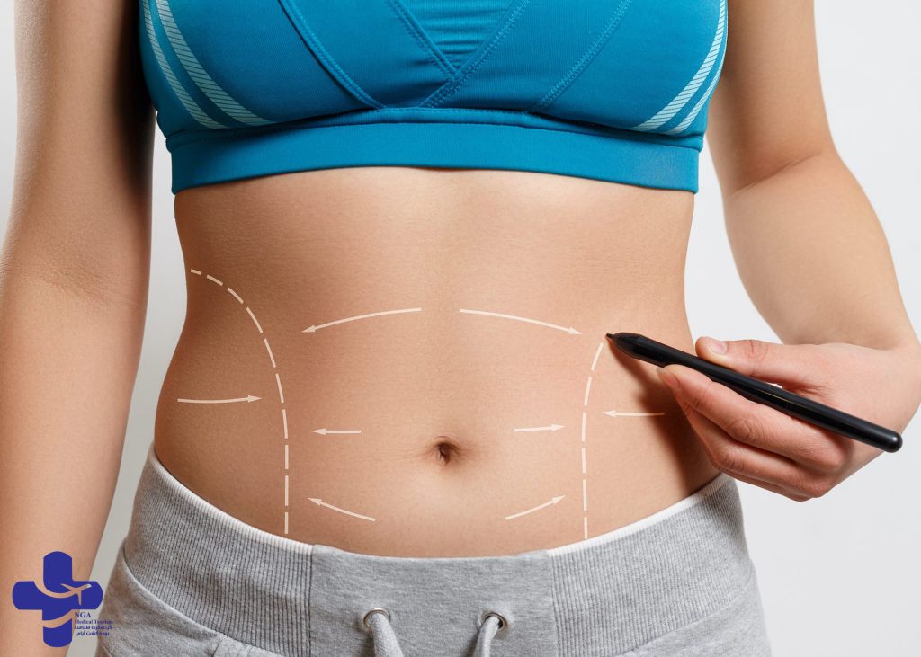 Liposuction in iran|How much is liposuction in iran 2023