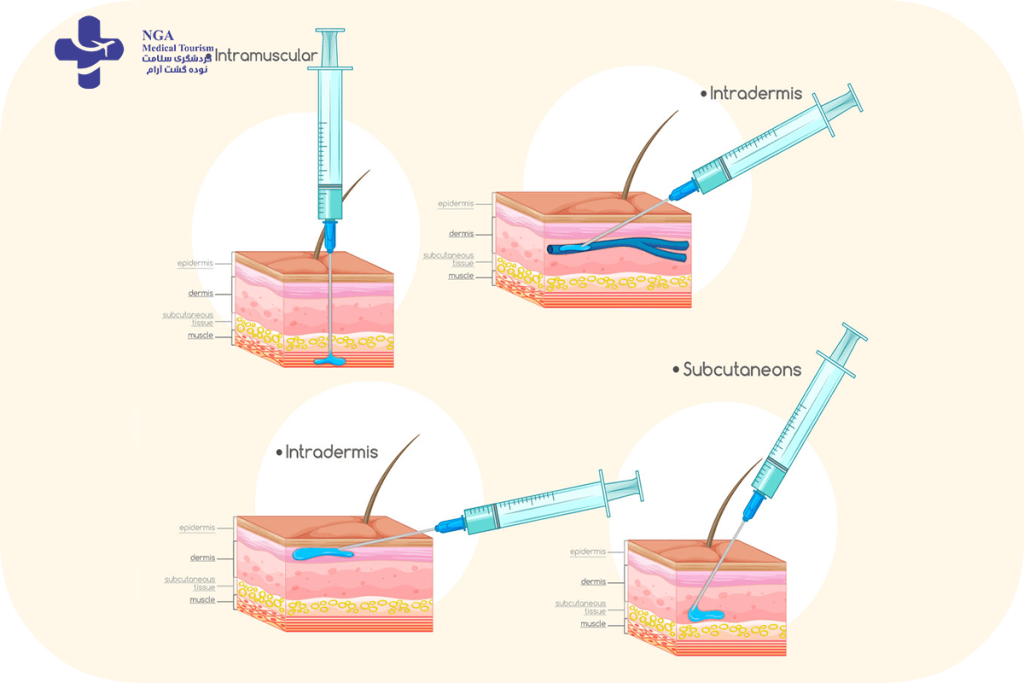 Types of IVF injections