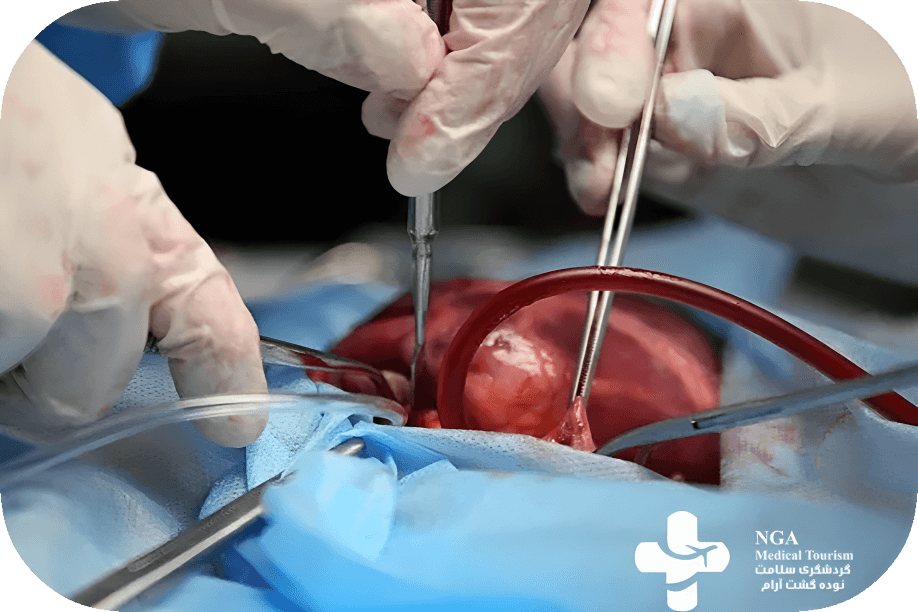 Procedure of Open Heart Surgery