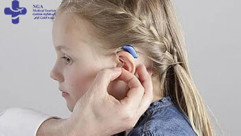 Cochlear Implant Surgery in iran