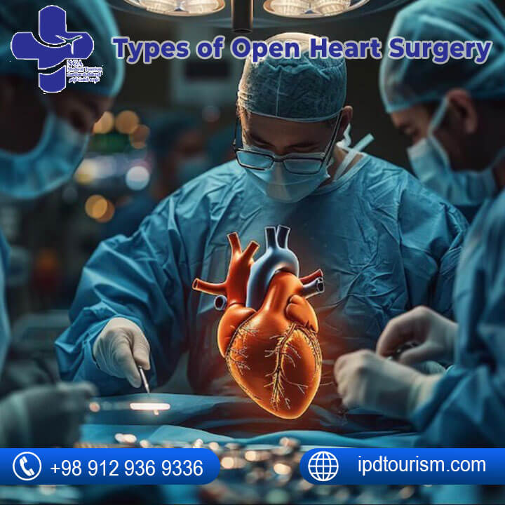 difference between bypass and open heart surgery-14