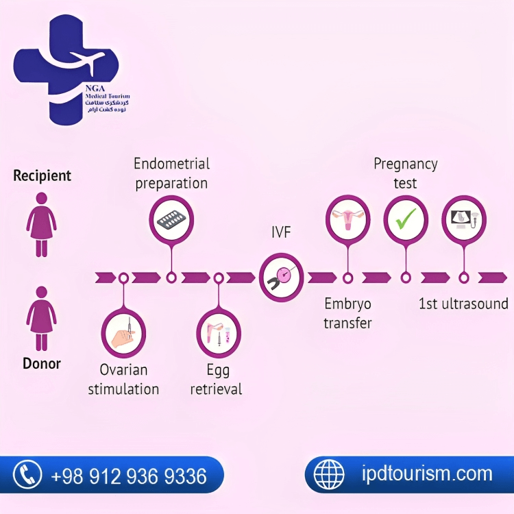 Egg Donation Timeline in Iran