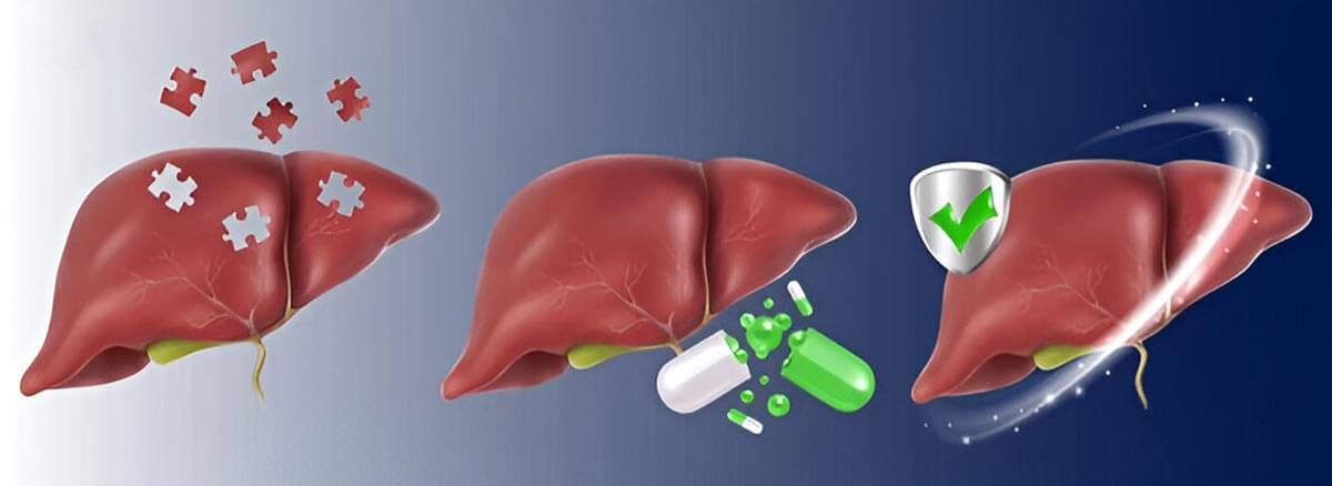 Liver Transplant for Bangladeshis-index
