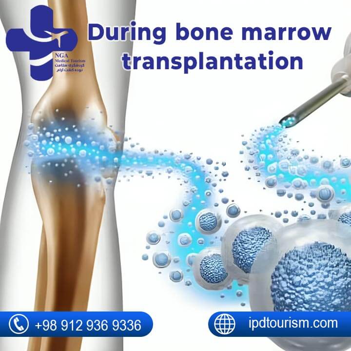 Bone marrow Transplant in Iran-5