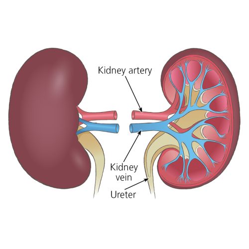 Kidney rejection